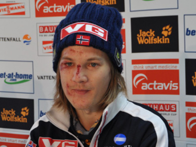 Tom Hilde lächelt wieder: "Alles halb so wild"