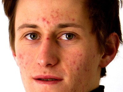 W杯男子札幌大会第1試合後のコメント