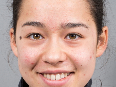 Равен Йип не получила серьезных травм